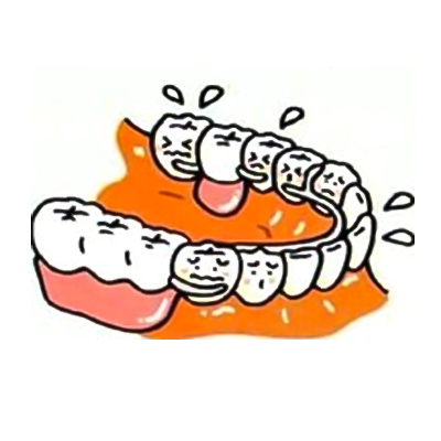 歯が数本抜けた場合　従来の治療法