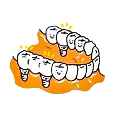歯が数本抜けた場合　インプラント治療法